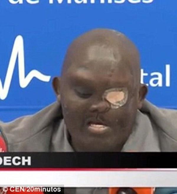 Δεν θα πιστεύετε τι αφαίρεσαν από το πρόσωπο του (Σκληρές Εικόνες) - Media