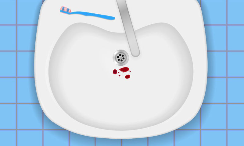 Ούλα: Πέντε λόγοι που ματώνουν όταν τα βουρτσίζετε - Media