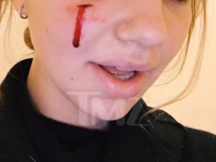 Η σκυλίτσα του Ομπάμα δάγκωσε 18χρονη - Όταν πήγε να τη χαϊδέψει (Photo, Video) - Media