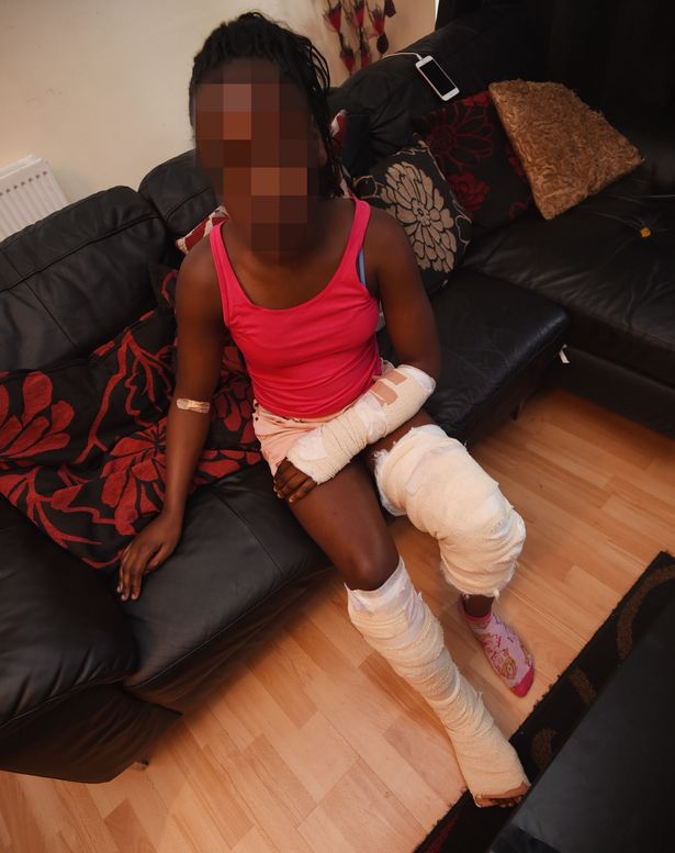 Σοκ στην Αγγλίας: Επίθεση σκύλου σε 11χρονο κοριτσάκι (Σκληρές Φωτογραφίες) - Media Gallery 3