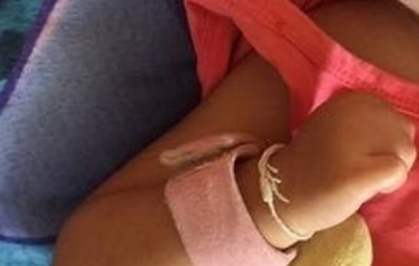 Σκληρές Εικόνες: Η σπαρακτική έκκληση οικογένειας για βοήθεια -Το κοριτσάκι τους γεννήθηκε παραμορφωμένο και χρειάζονται χρήματα για την εγχείρηση - Media