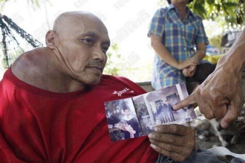 Απίστευτο! «Μεταφέρει» όγκο 10 φορές μεγαλύτερο από το κεφάλι του (Σκληρές Εικόνες) - Media