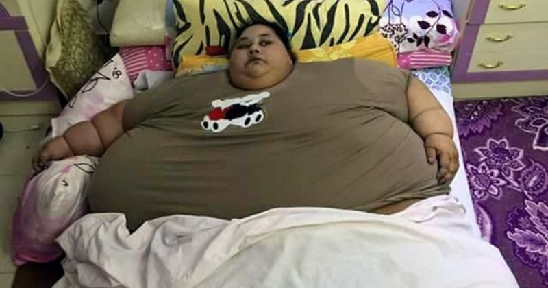 Εσπευσμένα στο χειρουργείο η «πιο παχύσαρκη γυναίκα στον κόσμο» - Ζυγίζει 500 (!) κιλά (Photos) - Media