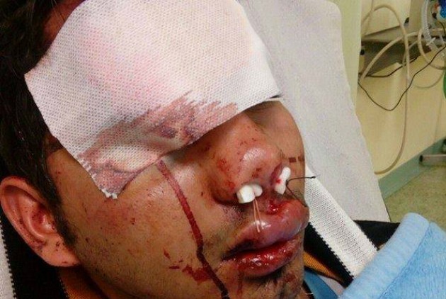 Απελαύνουν θύμα ρατσιστικής επίθεσης στον Ασπρόπυργο - Media