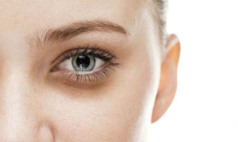 Πέντε τροφές που βοηθάνε να εξαφανιστούν οι μαύροι κύκλοι  - Media