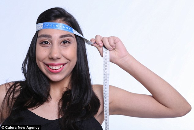 Το πρώτο μοντέλο με «μικροκεφαλία» - Καμπάνια ευαισθητοποίησης στη Βραζιλία (Photos-Video) - Media