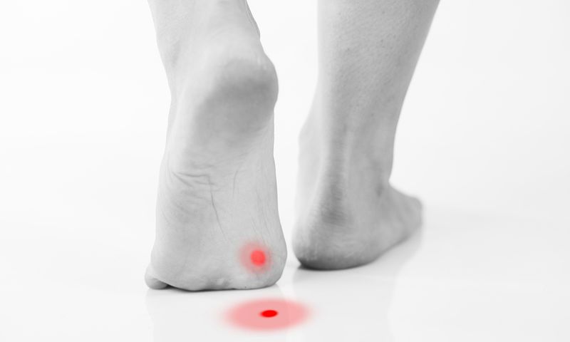 Νέα έρευνα: Ποια σχέση έχουν οι κάλοι στα πόδια με τον καρκίνο - Media