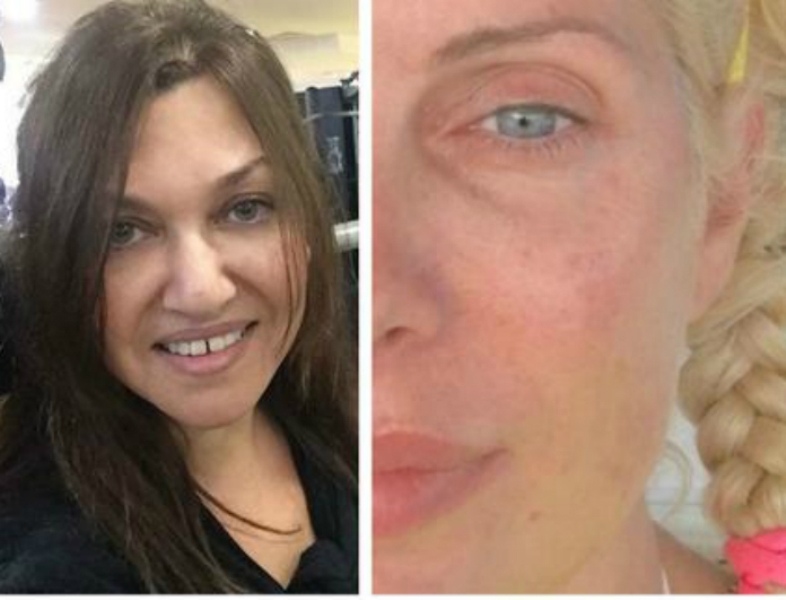 Πέντε Ελληνίδες σταρ …γυμνές - Έτσι είναι χωρίς μακιγιάζ (Photos) - Media