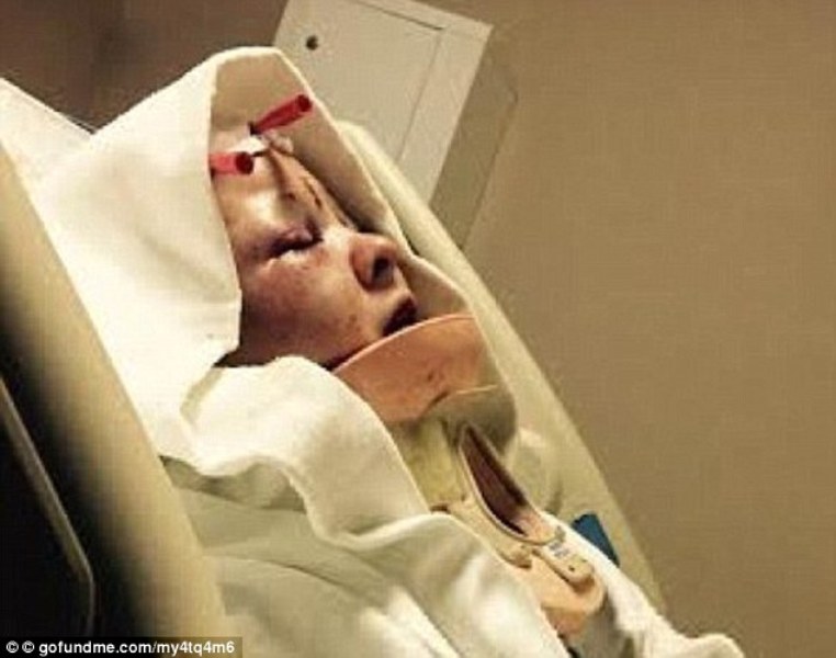 Ξερίζωσε με μαχαίρι το σκαλπ της συντρόφου του και έβαλε τον σκύλο του να την κατασπαράξει (Photos) - Media