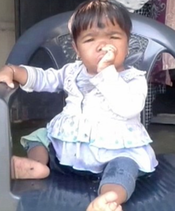 Είναι 11 ετών και έχει το ύψος και το βάρος ενός νηπίου - Media