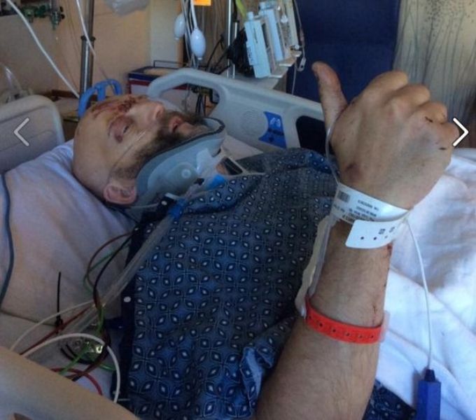 Στην εντατική γνωστός ηθοποιός από το «Χάρι Πότερ» (Video) - Media