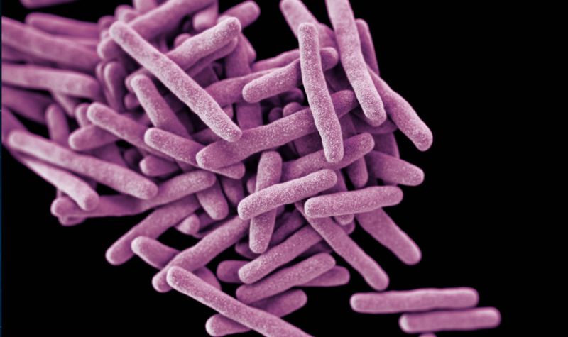 Κι όμως, η φυματίωση σκοτώνει και σήμερα - Media