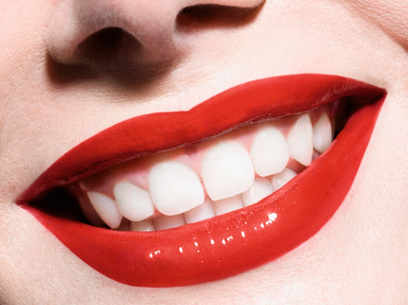 «Καμπανάκι» οδοντιάτρων για τη λεύκανση των δοντιών - Media