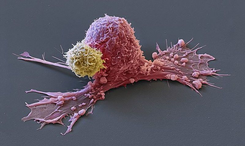 Η επίθεση του οργανισμού ενάντια στα καρκινικά κύτταρα μέσα από μοναδικές φωτογραφίες  - Media