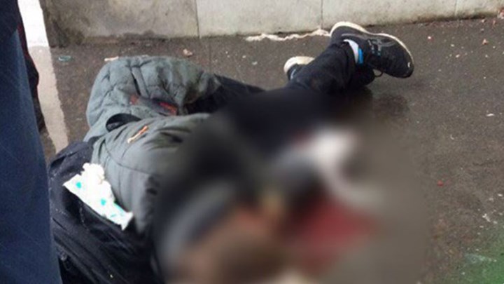 Έκρηξη στην Αγία Πετρούπολη - Νεαρός έχασε το χέρι του - Media