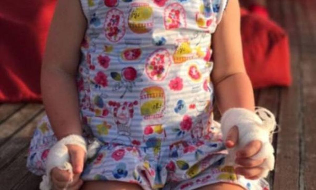 Tι έπαθε η μικρή στα χέρια της; Kατακραυγή στη διάσημη μαμά (Photos) - Media