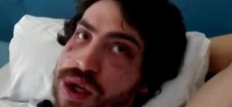 Σοκάρει ο φοιτητής που ξυλοκοπήθηκε άγρια από χρυσαυγίτες: Μου έριχναν κλωτσιές και μπουνιές στο κεφάλι (Video) - Media