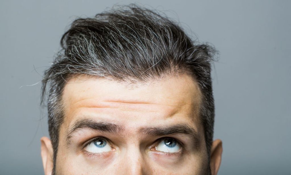 Τι αποκαλύπτουν οι άσπρες τρίχες για την υγεία της αντρικής καρδιάς - Media