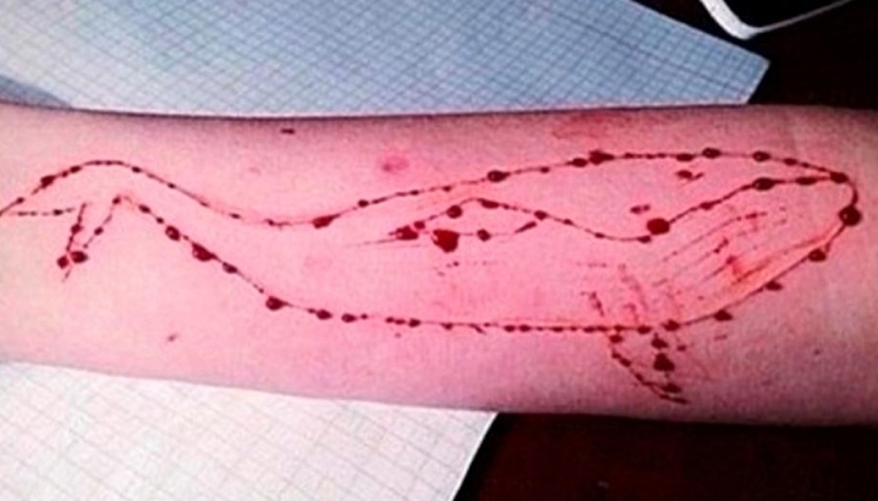 Η «μπλε φάλαινα» ξαναχτυπά: Αυτοτραυματισμός μαθήτριας στη Θεσσαλονίκη - Media