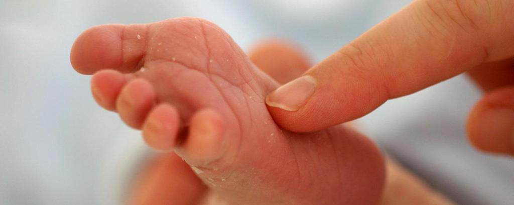 Οι αρχαίες «ρίζες» του γαργαλητού - Media