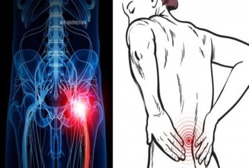 Μεγάλη προσοχή: Οι πόνοι στη μέση μπορεί να σημαίνουν κάτι πολύ πιο σοβαρό για την υγεία! - Media