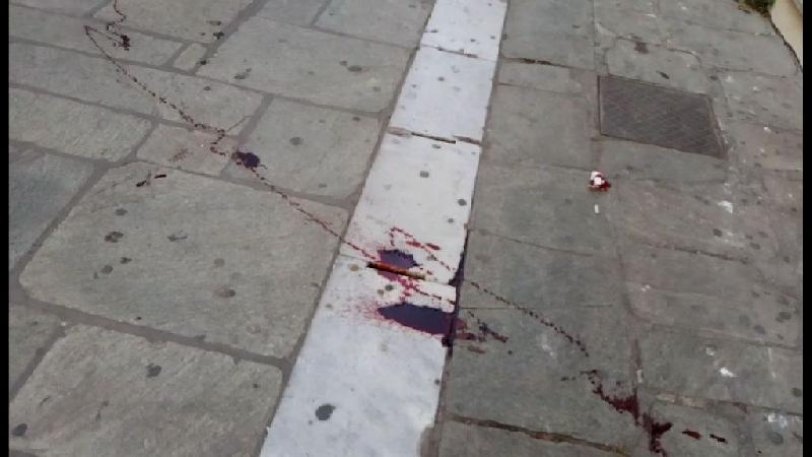 Άρχισαν τα ...όργανα: Επίθεση με μαχαίρι δέχθηκε οπαδός του ΠΑΟΚ στο Βόλο - Media