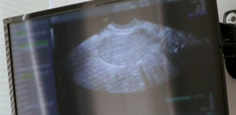 Άσχημα τα νέα για γνωστή τηλεπερσόνα: Οι ελπίδες για εγκυμοσύνη λιγοστεύουν  - Media