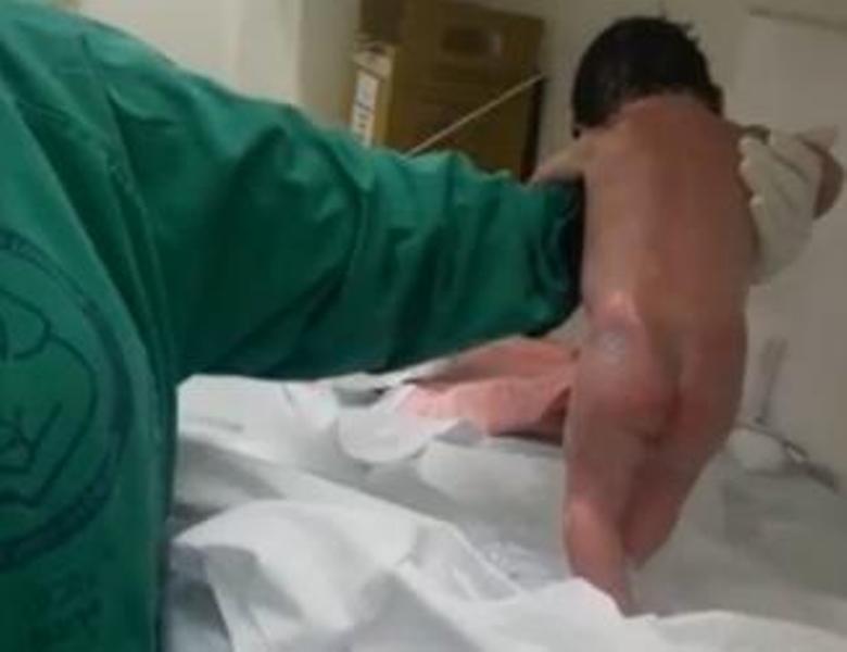 Aπίστευτο βίντεο: Το μωρό περπατάει αμέσως μόλις γεννήθηκε! - Media