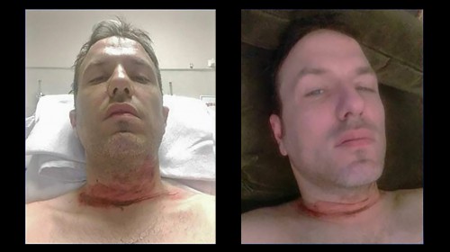 Πως ένας Έλληνας κορόιδεψε δεκάδες Καναδούς, επινοώντας ένα ατύχημα - Media