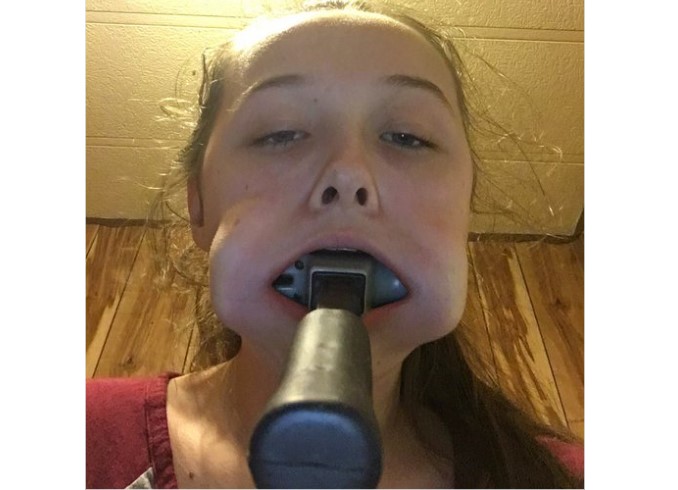 Έφηβη σφήνωσε σφυρί στο στόμα της και δεν μπορούσε να το βγάλει! Ο απίστευτος λόγος για τον οποίο το έκανε (Photos) - Media