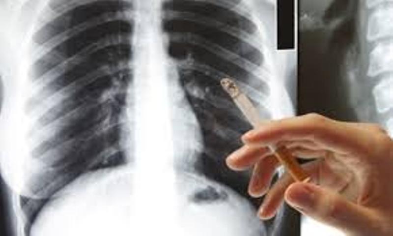 Οι τραγικές συνέπειες του τσιγάρου στους πνεύμονες: Το βίντεο που σόκαρε τους καπνιστές παγκοσμίως (Photos + Video) - Media
