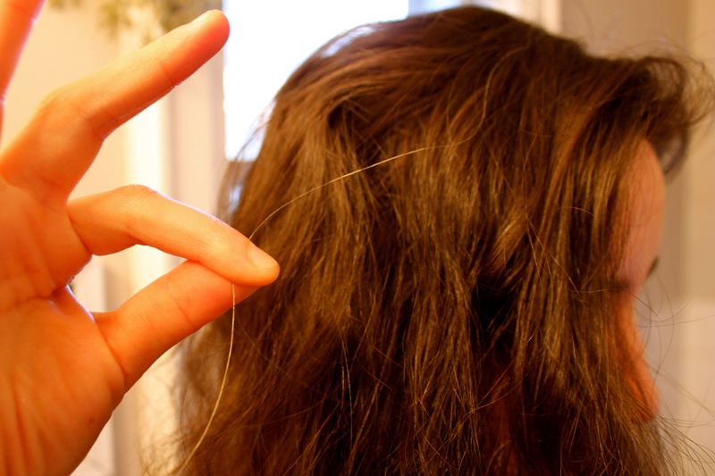 Γιατί ασπρίζουν τα μαλλιά; - Media