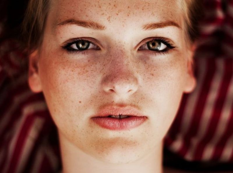 Η φυσική κρέμα που θα σας απαλλάξει οριστικά από τις πανάδες !  - Media