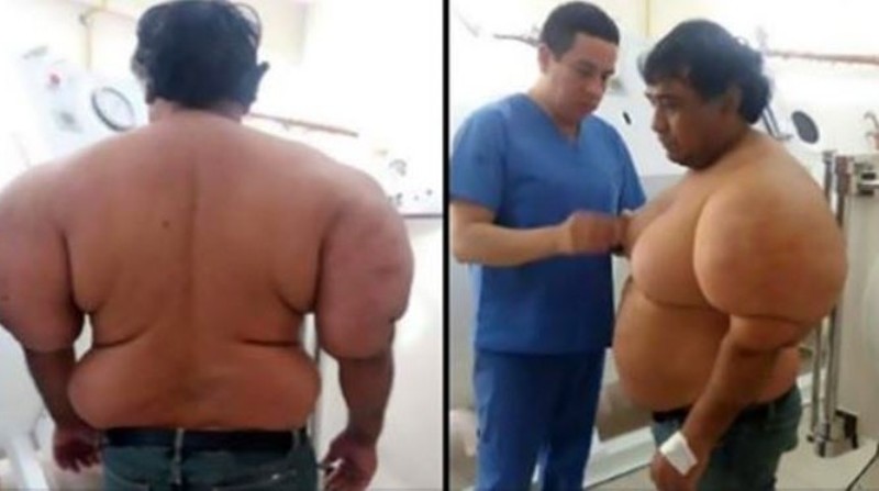 Αμέλησε τους κανόνες κατάδυσης και παραλίγο να πεθάνει (Photos + Video) - Media