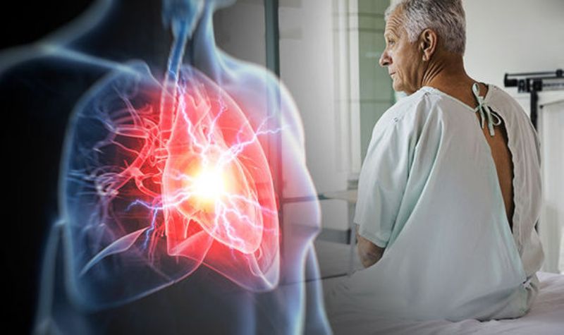 Καρδιακή προσβολή: Το σύμπτωμα - κλειδί δεν είναι ο πόνος στο στήθος (Video) - Media