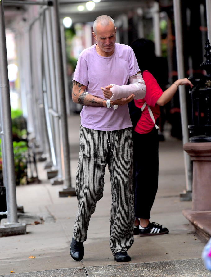 Τραυματισμένος γνωστός ηθοποιός μετά από σοβαρό τροχαίο (Photos) - Media Gallery 2