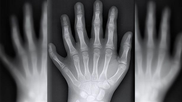 Απόβαση από 2.500 «Λεγεωνάριους» του «Legion Run Athens 2017» στον Ιππόδρομο Αθηνών  - Media