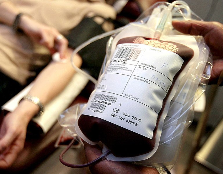 Προσοχή: Νέα μελέτη διαπιστώνει κίνδυνο λόγω μετάγγισης αίματος από γυναίκες σε άνδρες - Media