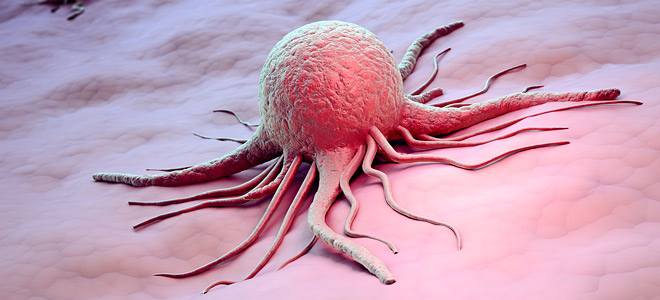 Καρκίνος: Πόσο πιθανό είναι σας συμβεί ανάλογα με ηλικία και φύλο (Πίνακες) - Media