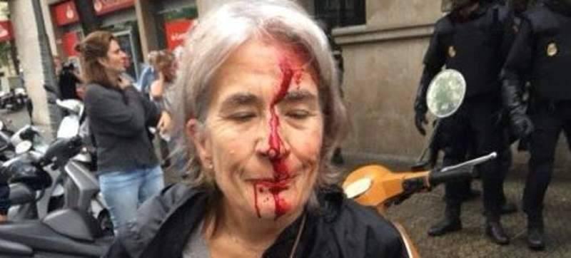 Προκαλεί ο Ισπανός ΥΠΕΞ: «Πλαστές» πολλές από τις φωτογραφίες αστυνομικής βίας - Media