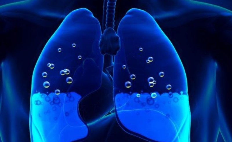 Προσοχή! Αν έχετε αυτά τα συμπτώματα, έχετε συσσώρευση υγρού στον πνεύμονα - Media