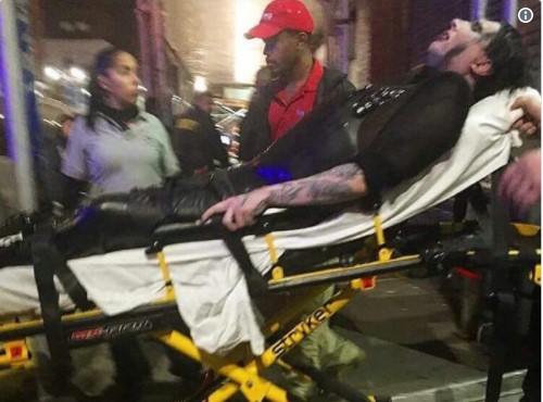 O σοκαριστικός τραυματισμός του Μέρλιν Μάνσον από τεράστια πιστόλια (Video) - Media