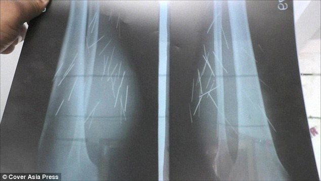 Πέθανε ο Μήτσος, ο «μεγάλος δραπέτης» του Αρκτούρου - Media