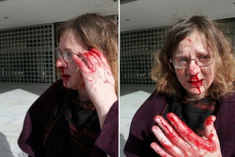 Αδιάψευστος μάρτυρας ο φακός - Νέα φωτογραφικά ντοκουμέντα από τη βιαιότητα χρυσαυγιτών κατά της Κουνιάκη - Media