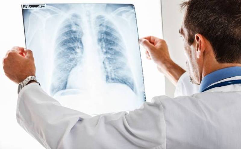 Κορωνοϊός: Τα πρέπει και τα μη για καπνιστές και ασθενείς με ΧΑΠ και άσθμα - Media