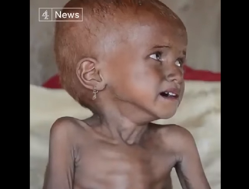 ΟΗΕ: Έντεκα εκατομμύρια παιδιά στην Υεμένη πεθαίνουν 130 καθημερινά (Videos) - Media