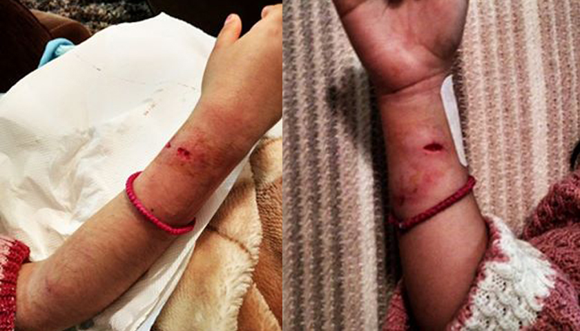 Λέσβος: Στο νοσοκομείο 7χρονη από επίθεση σκυλιών Στο «Χριστουγεννιάτικο Χωριό» - Media