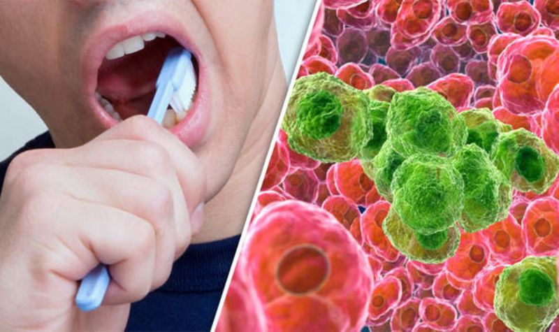Πώς συνδέεται ο καρκίνος του οισοφάγου με το βούρτσισμα των δοντιών!  - Media