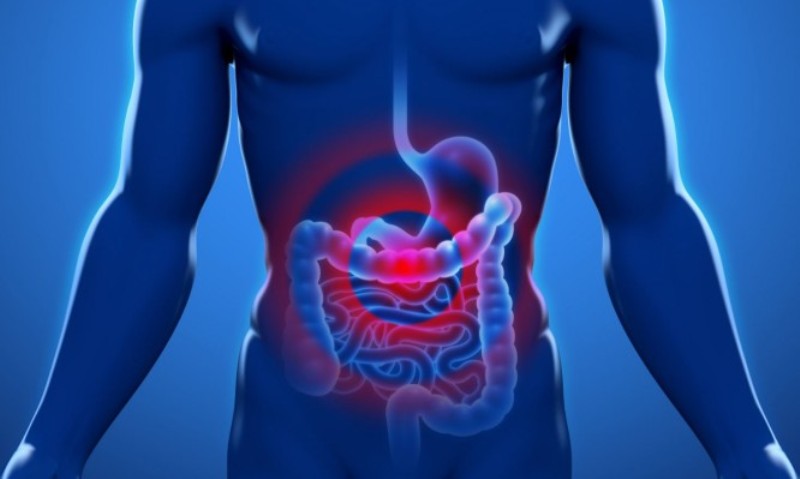 Καρκίνος του παχέος εντέρου – Συμπτώματα: 1 στους 4 τα μπερδεύει με αλλαγές στη διατροφή (Video) - Media