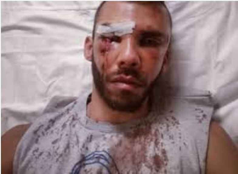 Εντοπίστηκαν οι Γάλλοι που είχαν γρονθοκοπήσει φοιτητή από το Μεσολόγγι - Αναζητούνται από τις Γαλλικές αρχές - Media